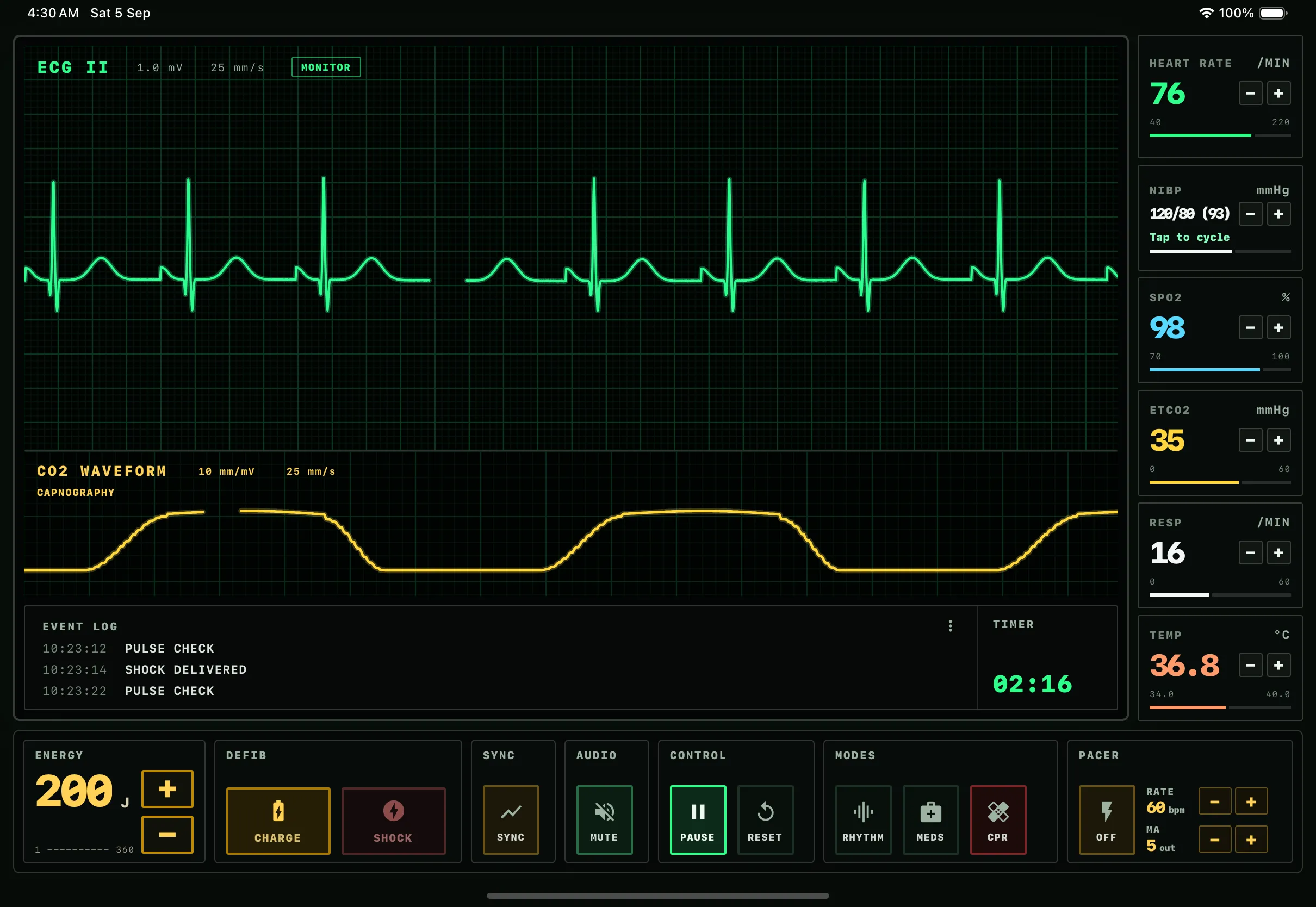SimRhythm patient monitor interface